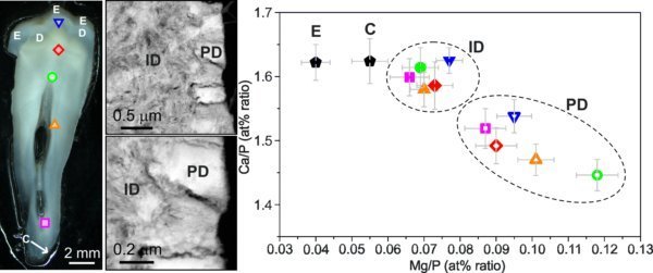 Nanochemistry and microsctructure of human dental tissues Nanochemistry and microsctructure of human dental tissues